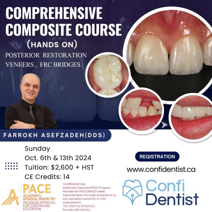 Comprehensive Composite