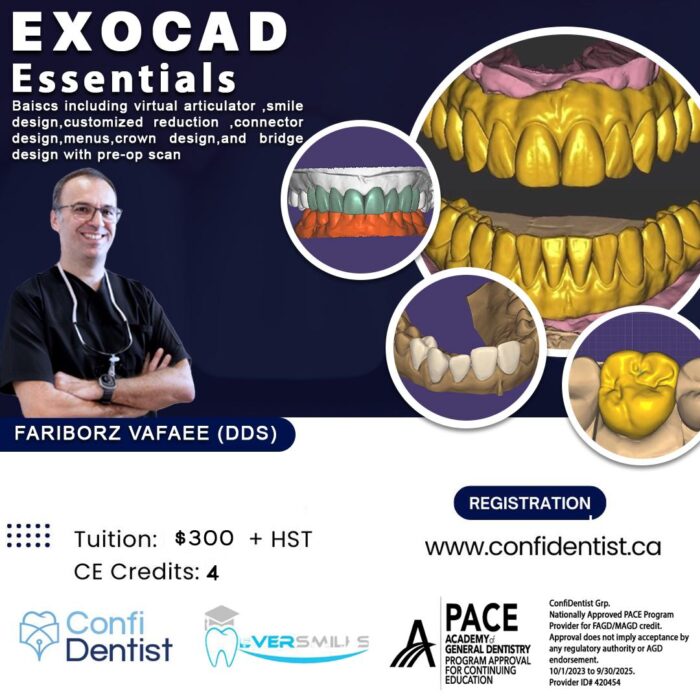 EXOCAD Essentials