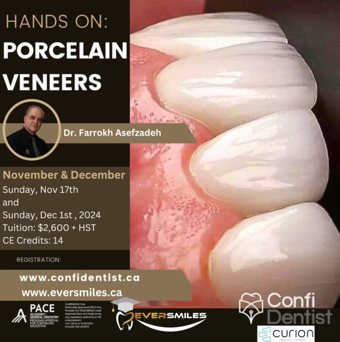 Porcelain Veneers