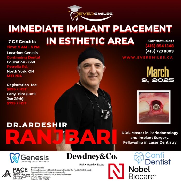 Immediate Implant Placement in Esthetic Area